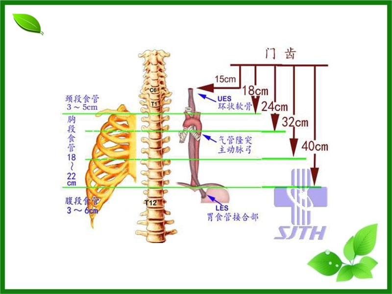 食道癌宣教.ppt_第3页