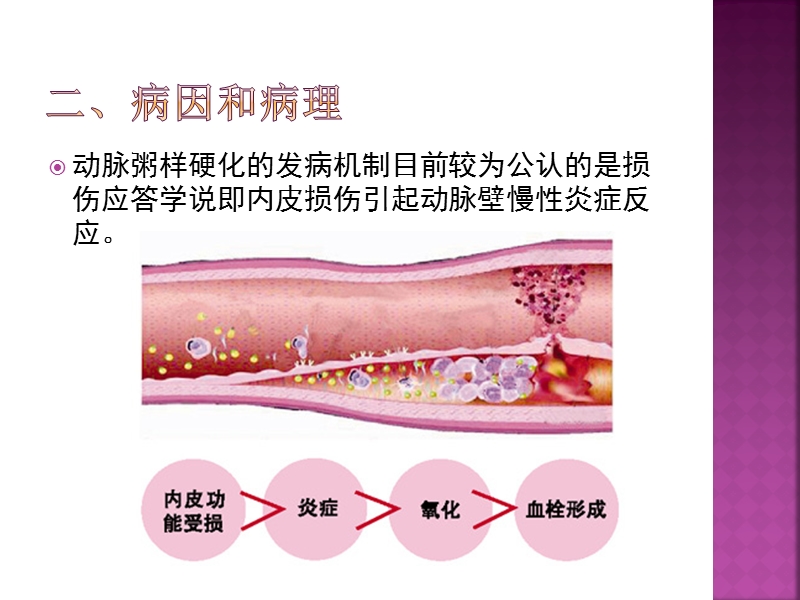 颈动脉硬化闭塞症.pptx_第3页