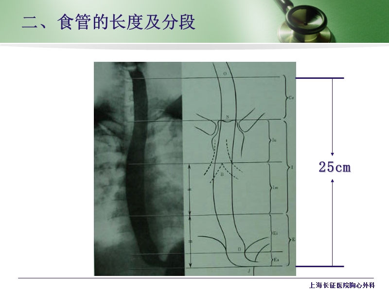 食管的常见疾病及其护理.ppt_第3页