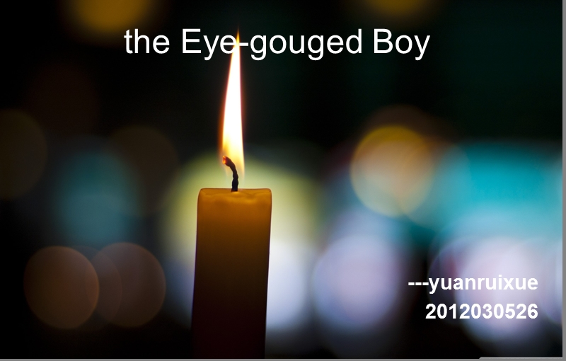 the-eye-gouged-boy-被挖眼的男孩.ppt_第1页