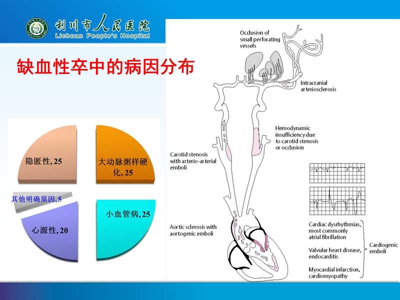 心源性卒中的抗栓治疗.pptx_第2页