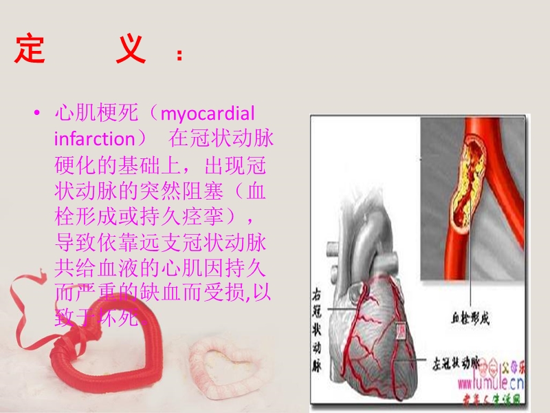 急性心肌梗死的查房护理.pptx_第3页