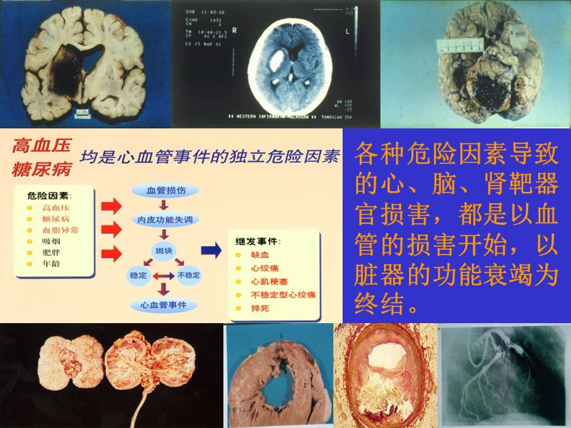 谢良地中华高血压杂志福建省高血压研究所福建医科大学附.ppt_第2页