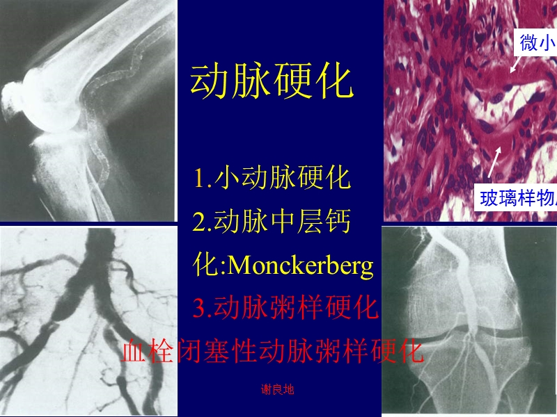 谢良地中华高血压杂志福建省高血压研究所福建医科大学附.ppt_第3页