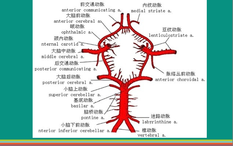 中枢神经系统血管性病变.ppt_第3页