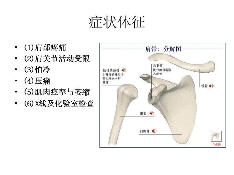 肩周炎的护理.ppt_第3页