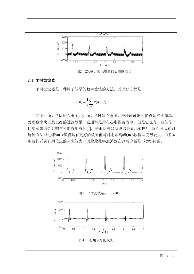 毕业设计翻译一种基于lms算法滤除心电图信号中50hz干扰的改良自适应滤波器.doc_第2页