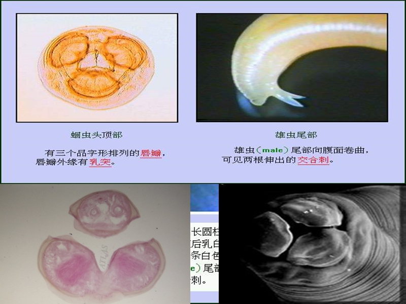 掌握鞭虫卵的形态特征.ppt_第3页