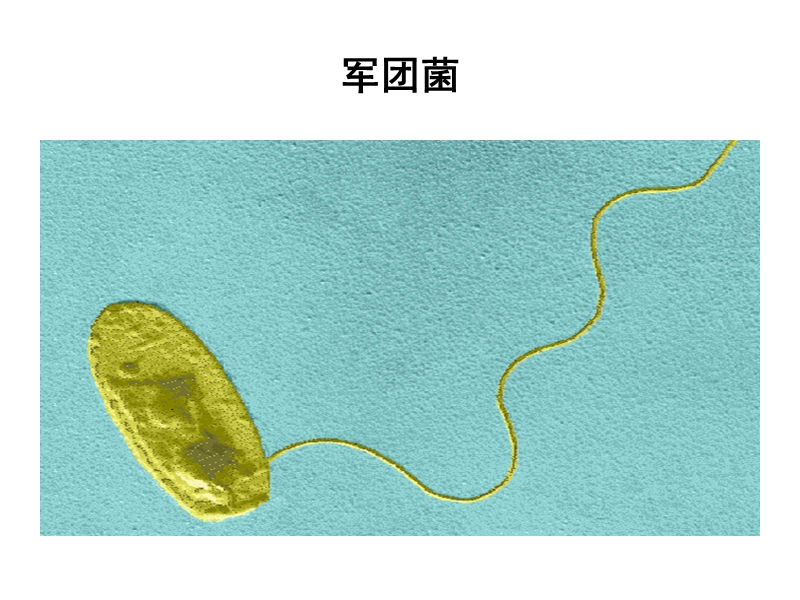 军团菌的分离培养与鉴定-福建省疾病预防控制中心.ppt_第3页