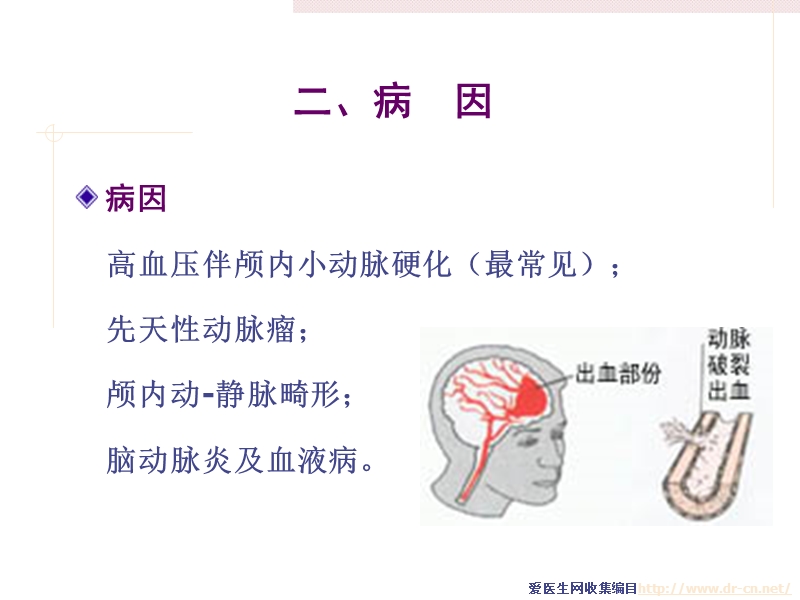 脑出血病人的护理.ppt_第2页