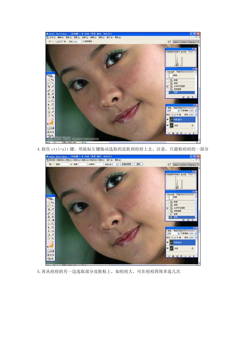 photoshop为清纯mm去痘美容的详细教程.doc_第3页