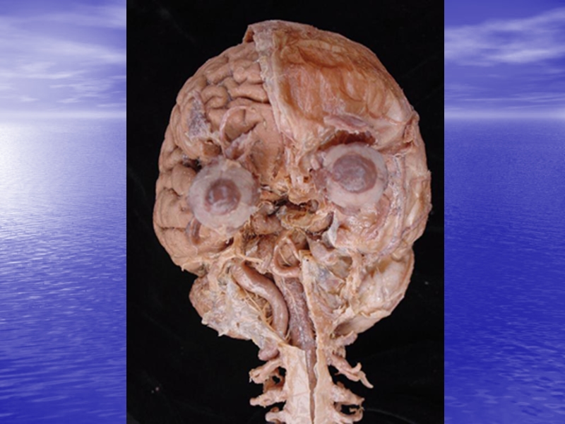 9-meninges ans vessle of brain and spinal cord.ppt_第3页