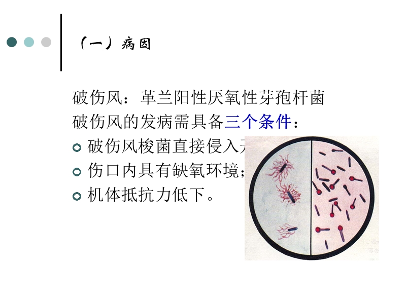 11.13破伤风.ppt_第2页